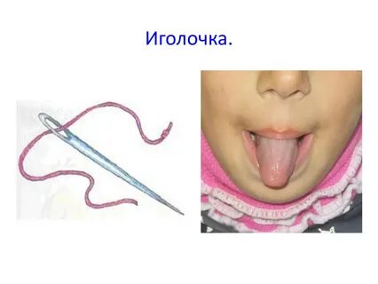 Язык иглы острее