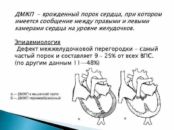 Мышечный дефект. Мышечный дефект