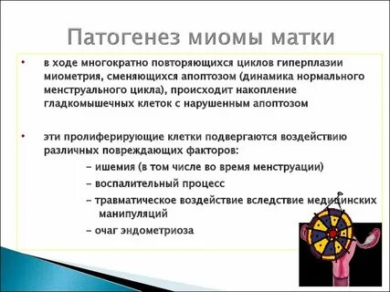 Миома матки по утвержденным клиническим рекомендациям 2020