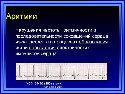 Аритмия возраст