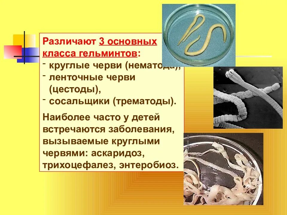 Аскаридоз этиология. Аскаридоз является. Аскаридоз является. Аскаридоз является. Аскаридоз является.