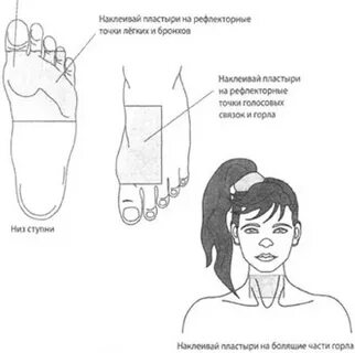 Можно клеить перцовый пластырь при кашле