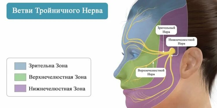 Заболевания тройничного нерва классификация. Воспаление тройничного лицевого нерва. Клинические симптомы невралгии 2 ветви тройничного нерва. Тейпирование тройничного нерва. Чем лечить лицевой тройничный нерв