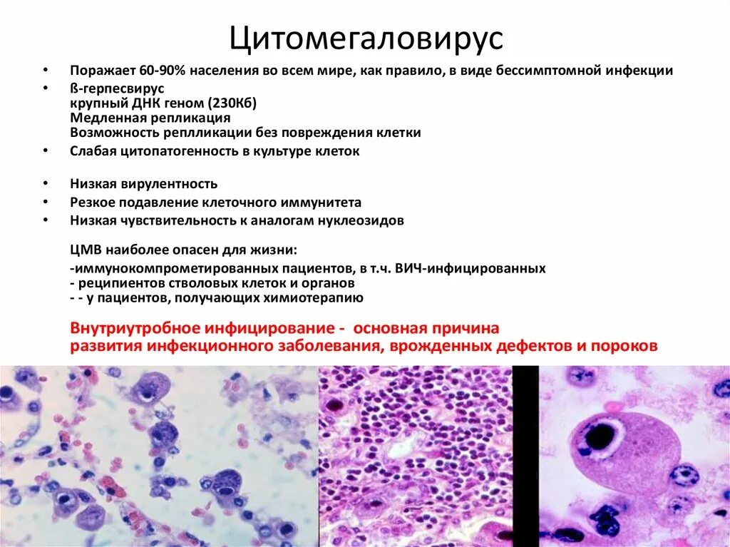 Цмв инфекция что это. Цитомегаловирусная инфекция гистология. Цитомегаловирусная инфекция клетки. Цитомегаловирусная инфекция микроскопия. Цитомегаловирус клетки Совиный глаз.