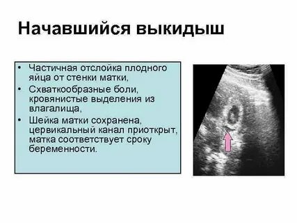 Выделения после узи форум