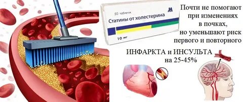 Холестерин при диабете