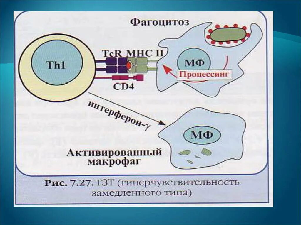 Гиперчувствительностью замедленного типа является тип гиперчувствительности. Гиперчувствительности замедленного типа (гзт). гиперчувствительность патанатомия. 4 тип гиперчувствительности иммунология. реакция гзт 4 типа.