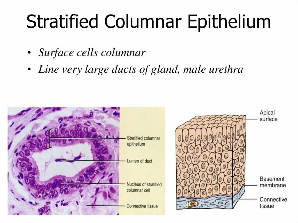 Surface definition