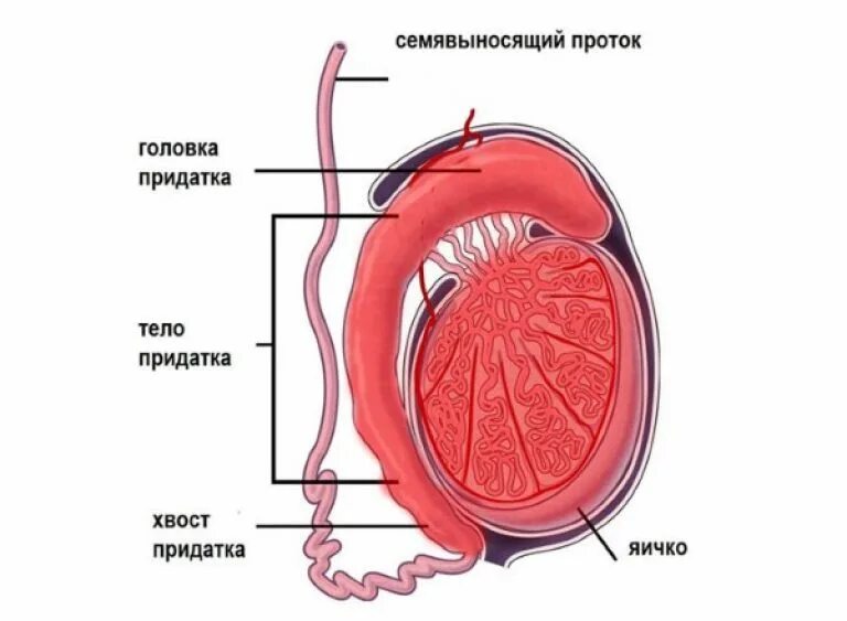 Воспаление придатка яичка симптомы. Придаток яичка. воспаление придатка яичка. острый орхоэпидидимит.