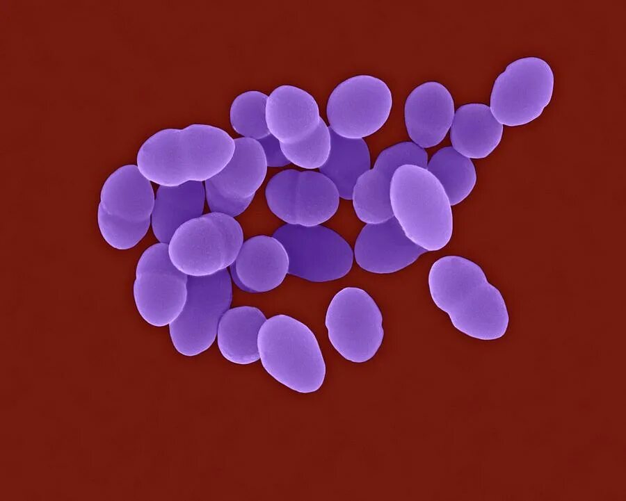 Streptococcus pneumoniae haemophilus influenzae streptococcus. Streptococcus pneumoniae (пневмококк). бета гемолитический стрептококк. бетта гемолитич стрептококк. стрептококки каталазоположительные.