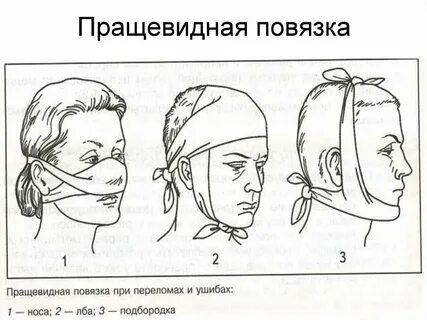 Какая повязка при кровотечении