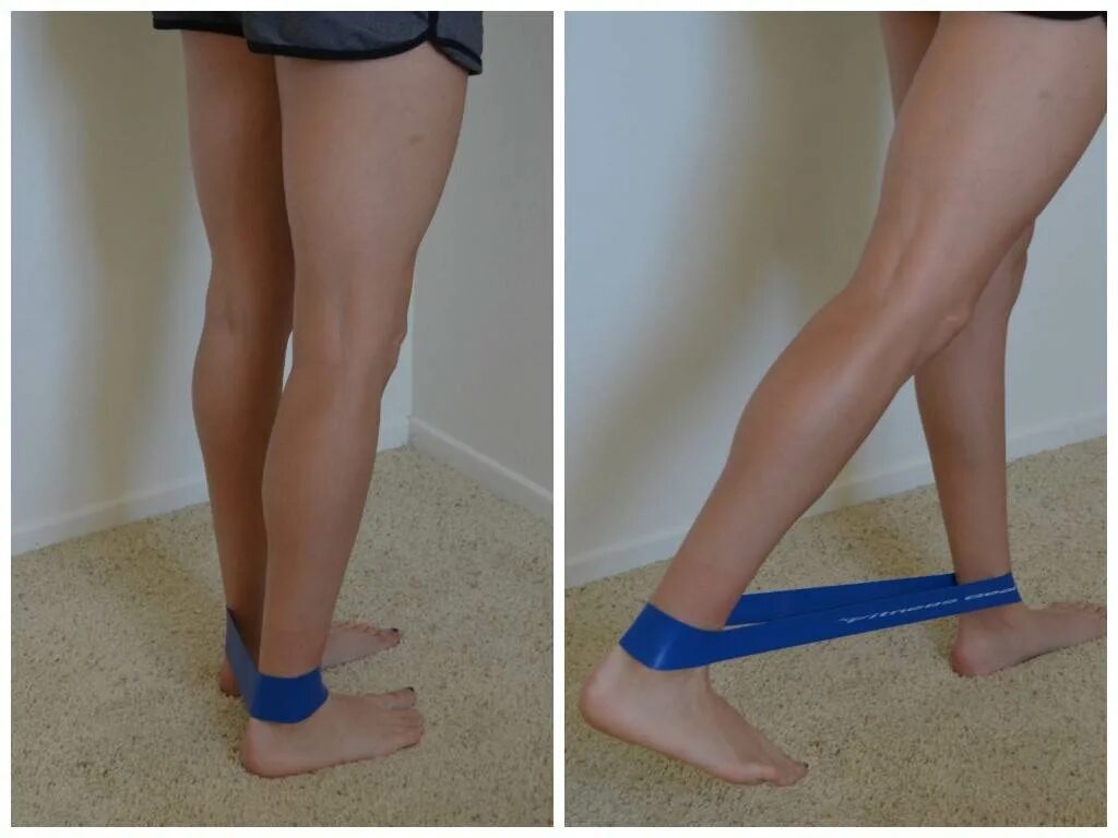 Делай ноги. Искривление ног аппарат илизарова. Что можно сделать с ногой. Что можно сделать с ногой. Упражнения при пяточной шпоре.