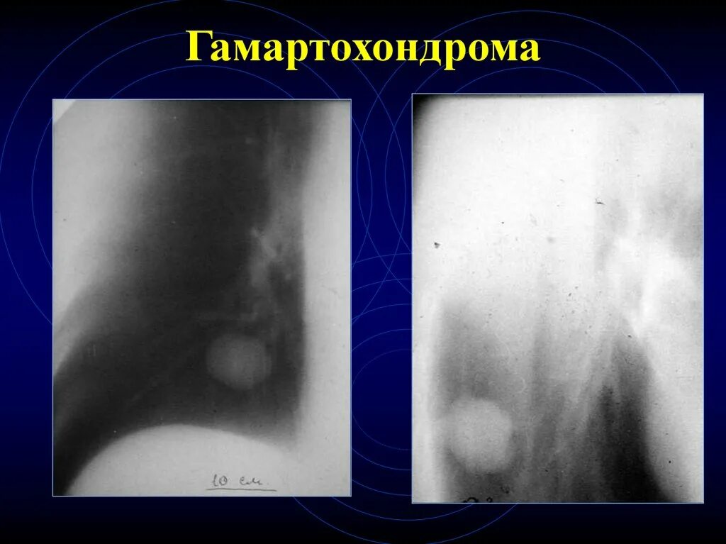 Образование в легком форум