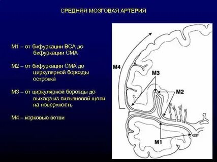 Бассейн средней мозговой артерии