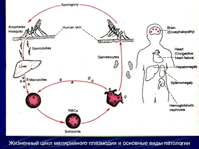 Как происходит заражение человека малярийным плазмодием. Жизненный цикл малярийного плазмодия. Стадии жизненного цикла малярийного плазмодия. Опишите жизненный цикл малярийного плазмодия.. Стадии жизненного цикла малярийного плазмодия таблица.