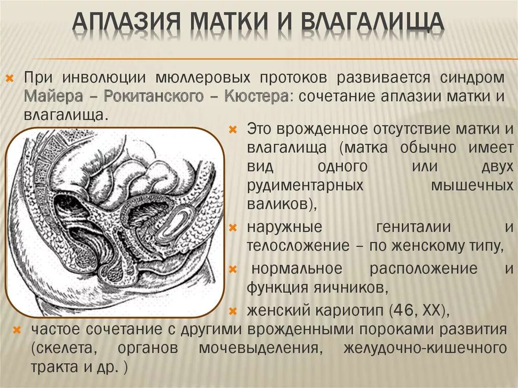 Лечение аплазии