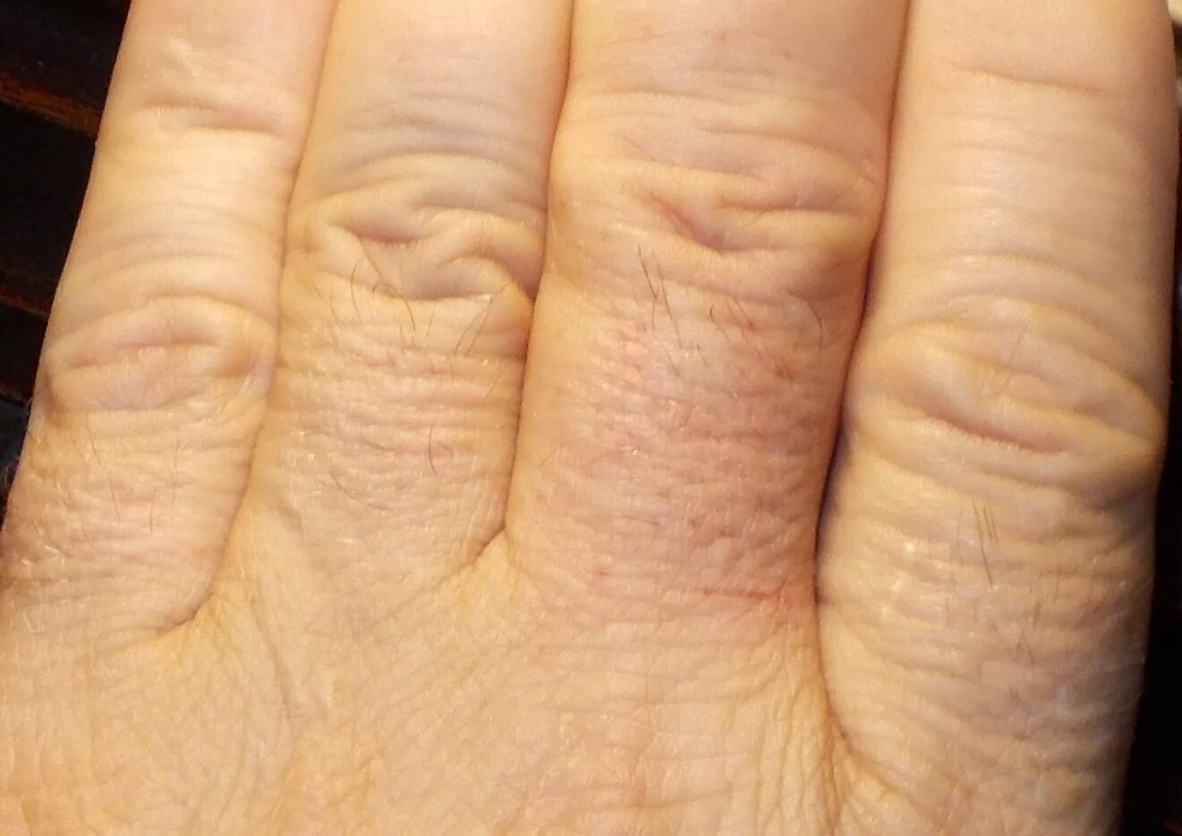 Волосы на пальцах рук у девушек. Волосы на пальцах рук у девушек. Брахидактилия меган фокс. Женская кисть руки. Волосы на пальцах рук у девушек.