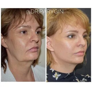 Вакансии пластическая