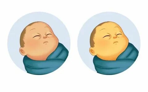 Ядерная желтуха