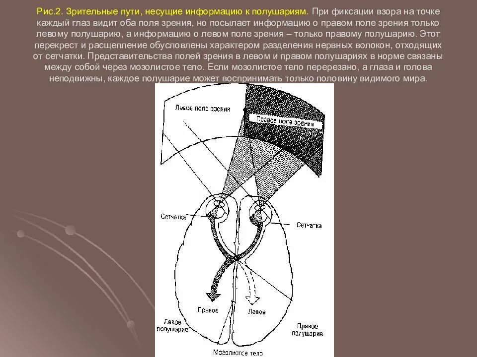 Левый глаз полушарие. Задержка речевого развития. Левый глаз полушарие. Левое и правое полушарие мозга мышление. Левое полушарие.