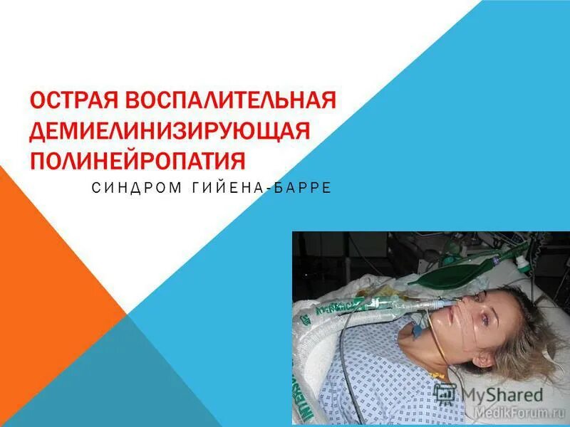 острая воспалительная полинейропатия. острая воспалительная демиелинизирующая полирадикулонейропатия. острая воспалительная демиелинизирующая. острая демиелинизирующая полинейропатия. демиелинизирующая полирадикулоневропатия.