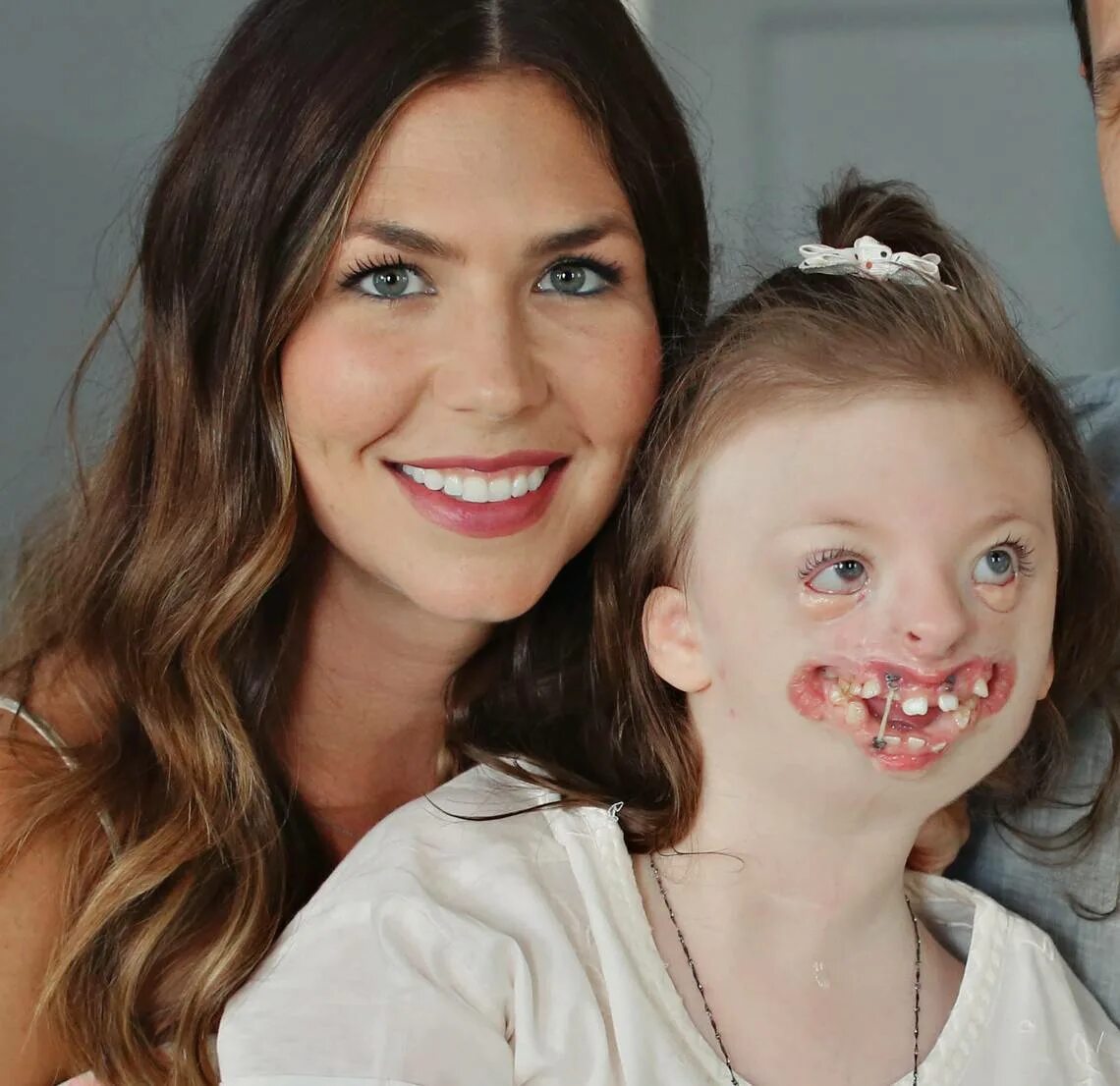 Синдром софии. Синдром софии. Синдром софии. Софья уивер синдром ретта. София уивер синдром ретта.