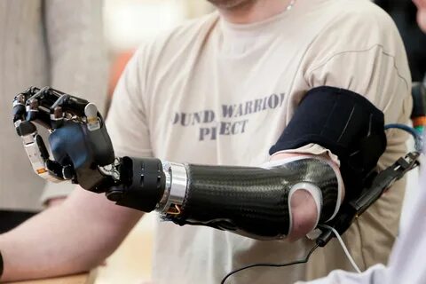 Robotics limb