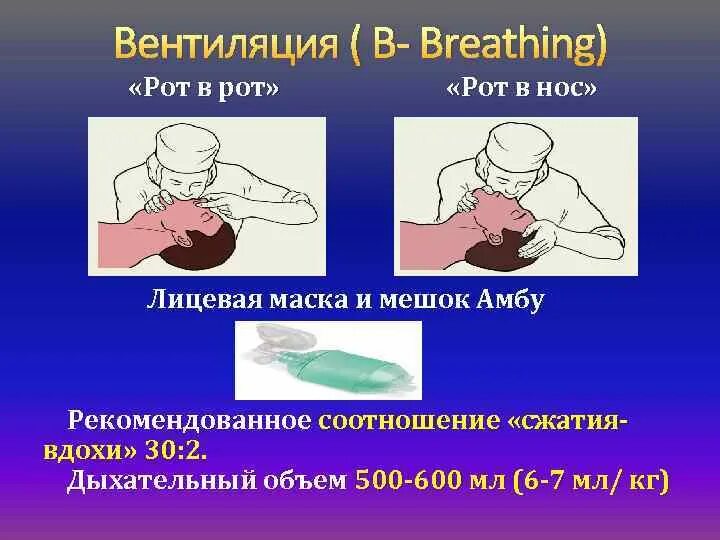 Проведение искусственного дыхания рот в нос. Искусственная вентиляция легких методом рот в нос. Сердечно-легочная реанимация рот ко рту. Вентиляция легких рот в нос.