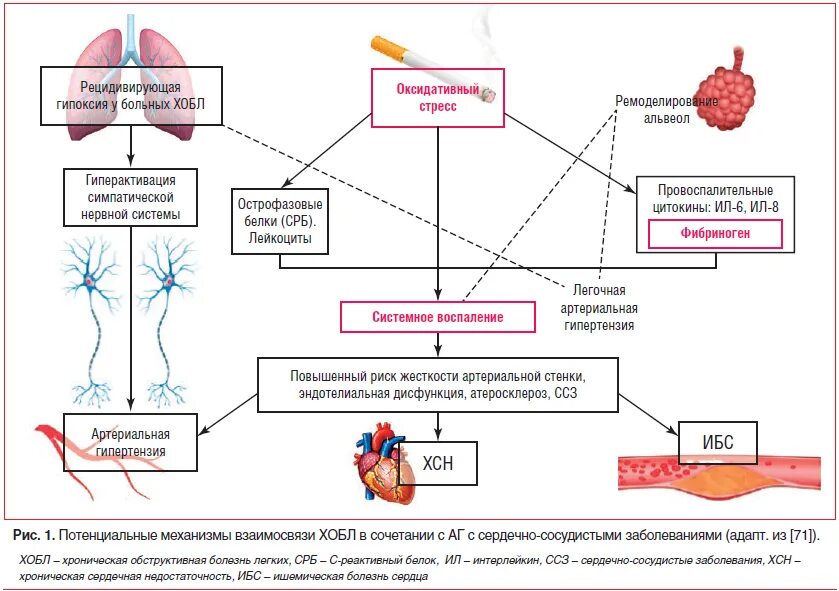 Гипертония диабет лечение. Хроническая обструктивная болезнь патогенез. Механизм развития ХОБЛ. Хроническая обструктивная болезнь легких патогенез. Патогенез развития легочной гипертензии.