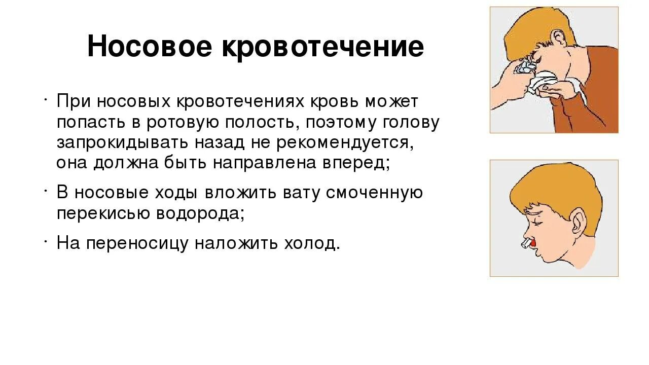 Сморкаюсь с кровью почему. Причины носового кровотечения. Нлсовоеткровоьечение у детей. При носовом кровотечении.