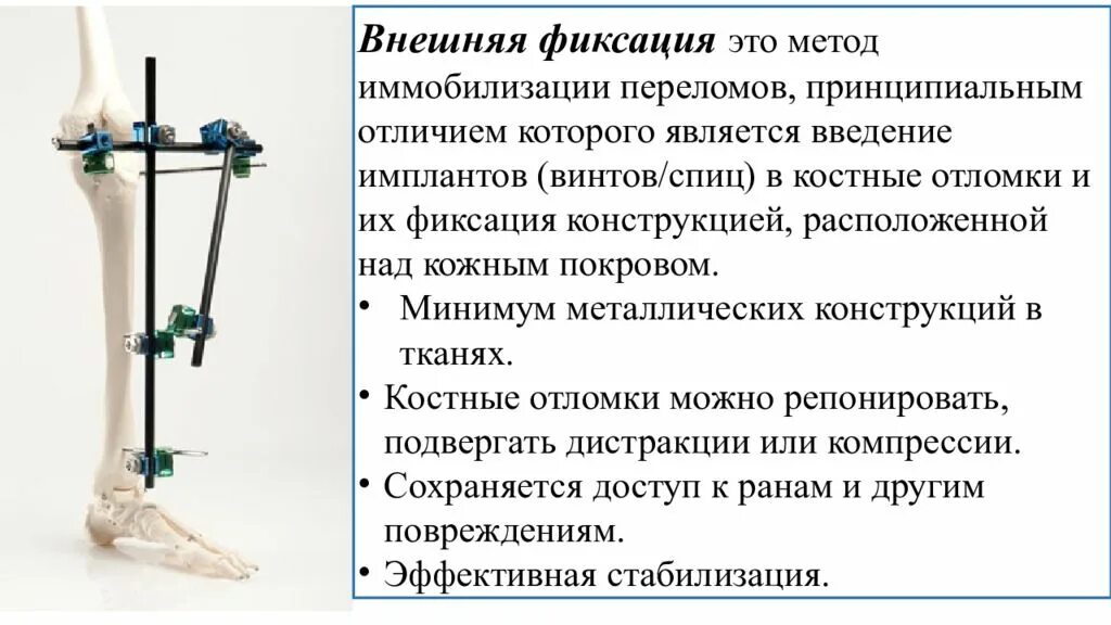 Фиксация определенного положения которое занимает