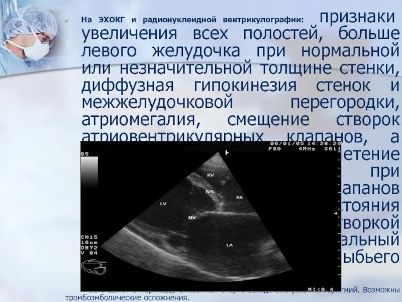 Диффузные изменения левого желудочка сердца