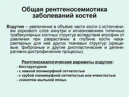 Врожденные заболевания костей