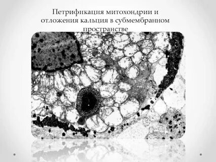 Отложения кальция