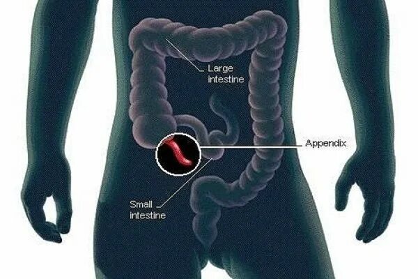 Pictures Of Cecum Healthiack