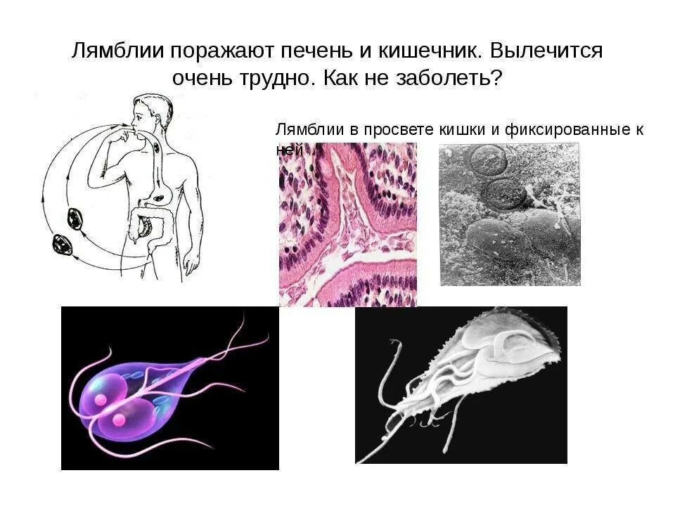 Лямблии у взрослых в печени лечение симптомы. Паразиты в печени лямблии. паразит лямблия симптомы. лямблия кишечная патогенность. кишечные паразиты лямблии.