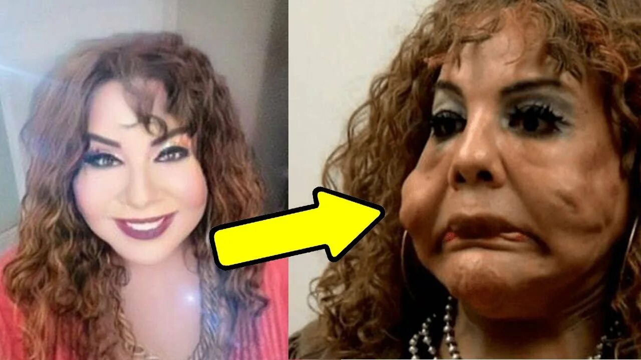 Грудные импланты mentor 275 мл 300 мл. Форма из силиконового герметика. Силикон для швов в ванной. Силиконовые губы. Силикон для форм tooldecor t20 237.