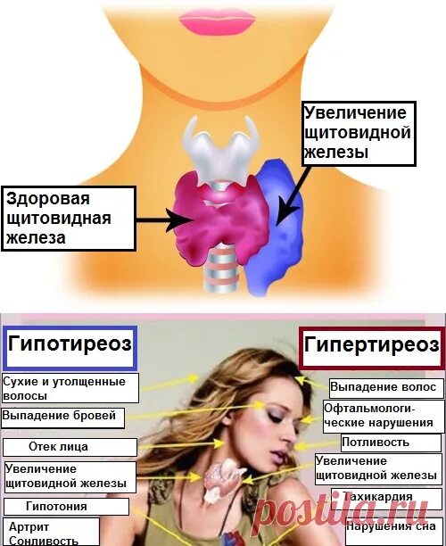 Здоровая щитовидная железа. Гипотиреоз щитовидной железы. Уменьшенная щитовидная железа.