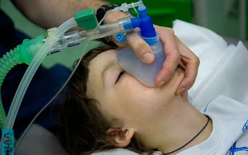 Наркоз отзывы о процедуре. Ингаляционный наркоз. общий наркоз ингаляционный. ингаляционный наркоз масочный. ингаляционная анестезия.