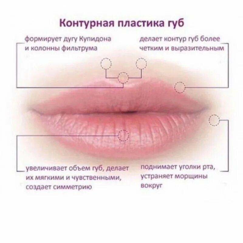 Почему нельзя делать губы. Схема уколов гиалуроновой кислоты на губах. контурной пластики губ. схема коррекции губ. техники введения филлеров в губы.