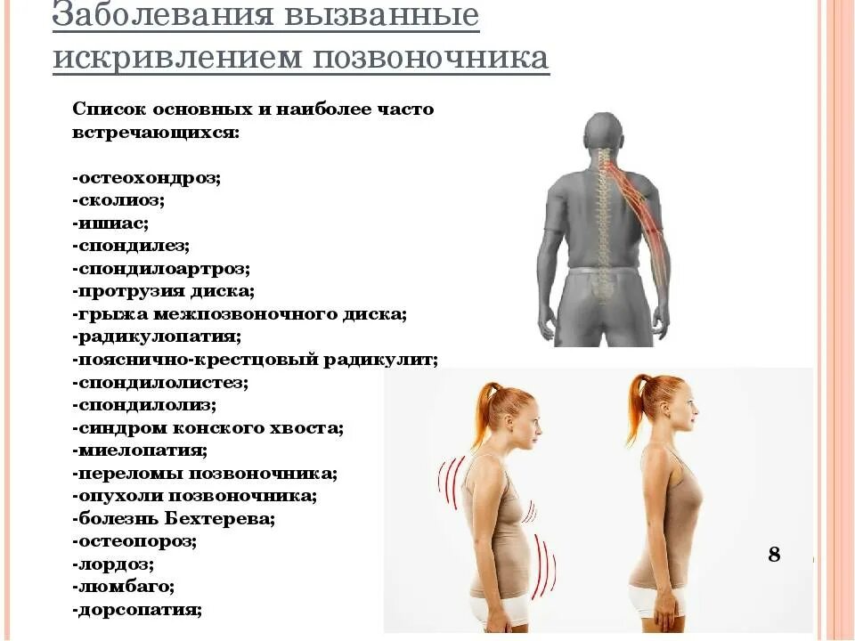 Как болит поясница симптомы. Болезни спины. Заболевания спины и позвоночника. Болезни спины и позвоночника названия.