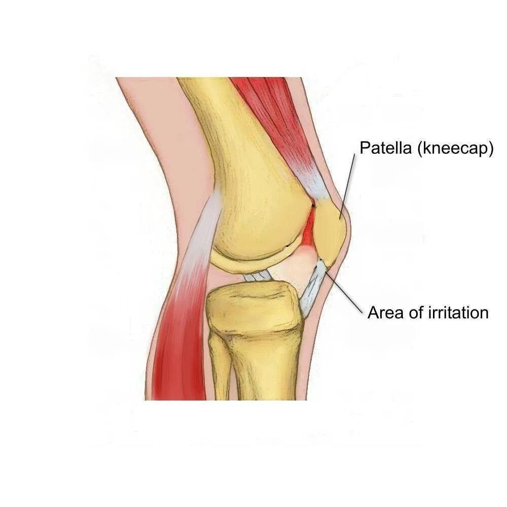 Колена ли. Коленный сустав строение пателла. Коленная чашечка анатомия. Хондропатия надколенника.