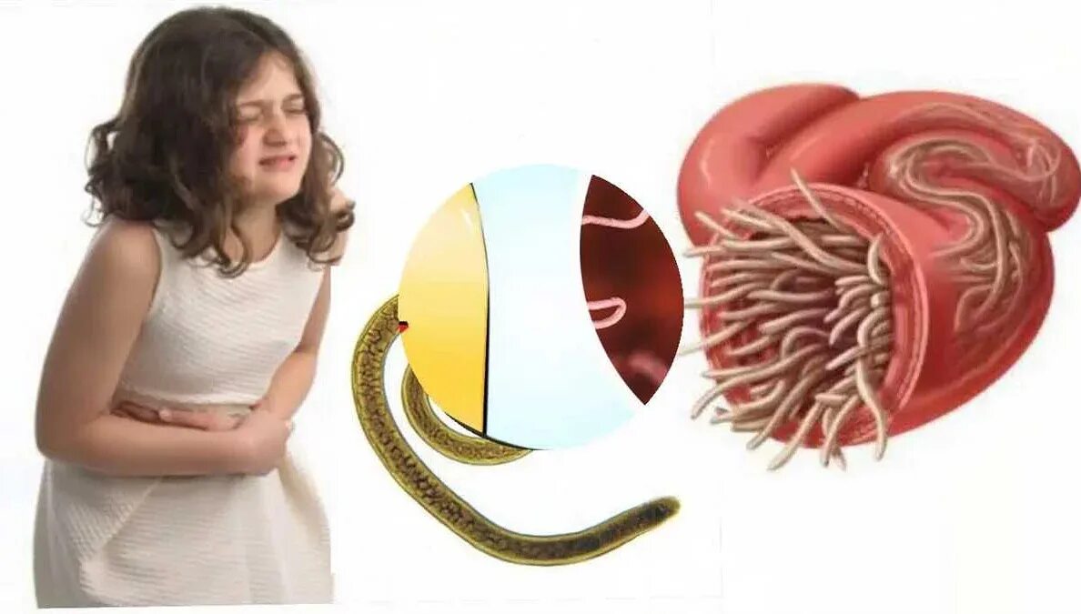 Паразиты в организме человека глисты. Паразиты в организме человека глисты. Гельминты аскариды токсокары. Гельминты острицы аскариды. Паразиты в организме человека глисты.