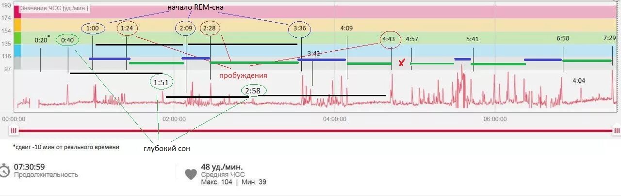 Rem быстрый сон. Rem стадия сна. Стадии non Rem сна. Прохождение 3 глубокий сон