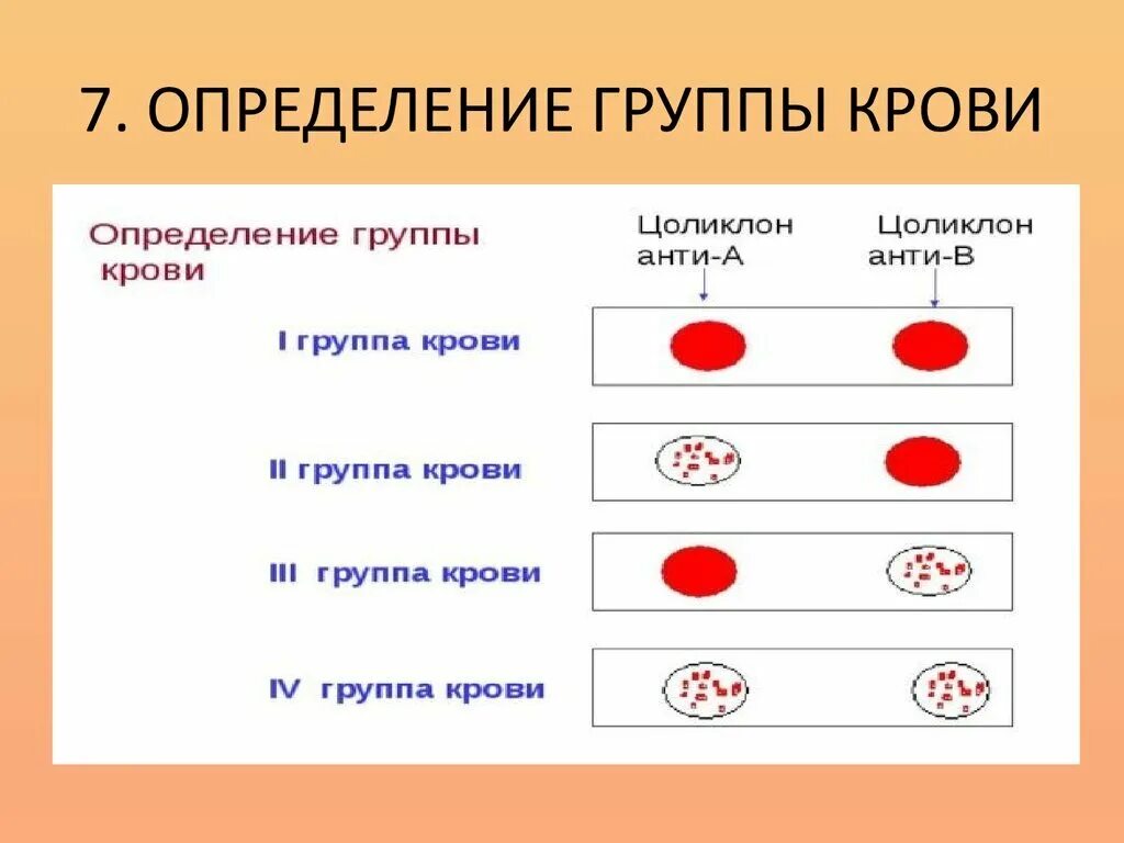 Реакция агглютинации с цоликлонами. Определение гр крови цоликлонами алгоритм резус фактор. определение грикрови цоликлономи. группа крови цоликлоны резус фактор. методика определения резус фактора цоликлонами анти д.