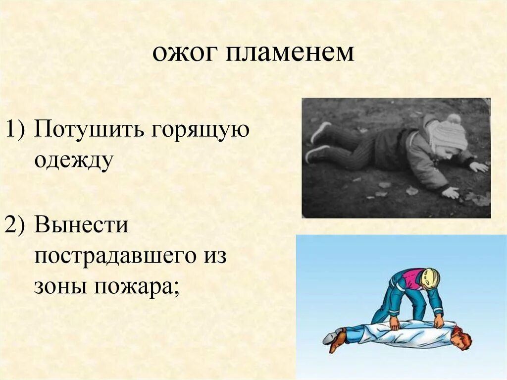Ожоги при пожаре. Оказание помощи пострадавшим при пожаре. оказание первой помощи пострадавшему при пожаре. оказание 1 помощи пострадавшим при пожаре.