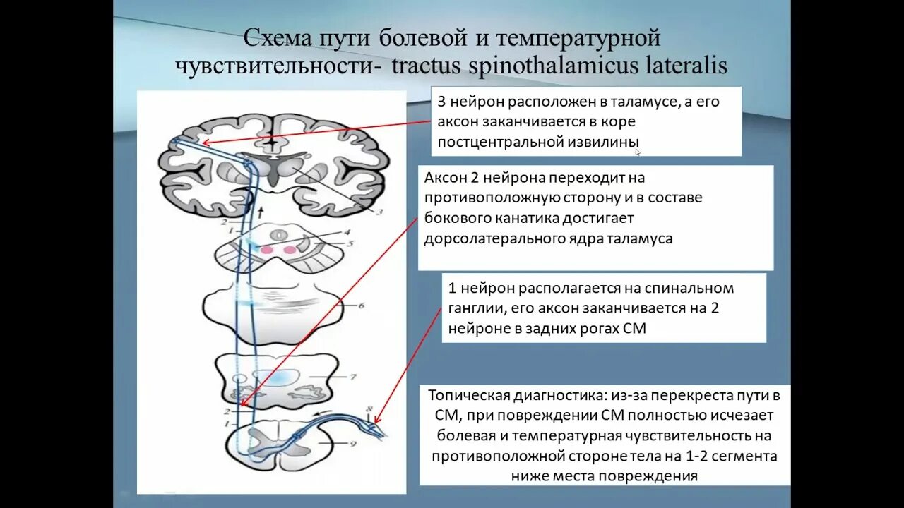 Спиноталамический путь схема неврология. Схема проводящих путей болевой и температурной чувствительности. Путь болевой температурной и тактильной чувствительности. Латеральный спиноталамический тракт.