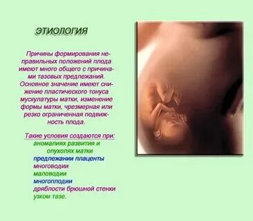 Многоводие на 38 неделе