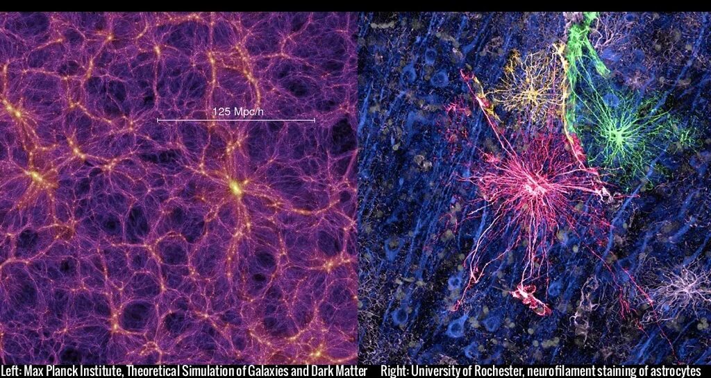 Скопление живых организмов. Нейроны похожи на вселенную. Структура Вселенной и головного мозга. Нейронная сеть и Вселенная. Нейроны космос.