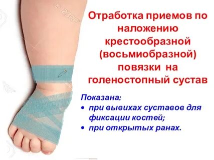 Мазь при вывихе голеностопного